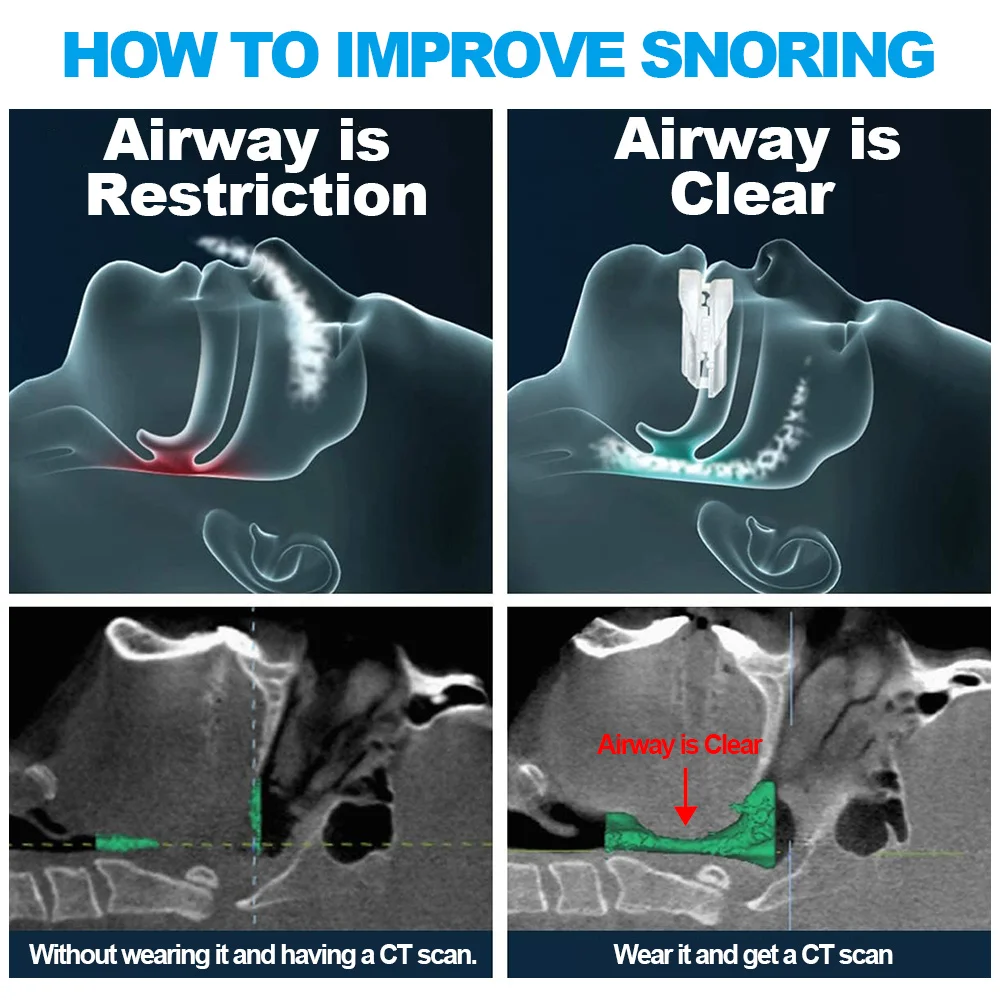 Pelindung mulut penggiling gigi Anti mendengkur meningkatkan tidur dan mencegah Bruxism, perangkat Anti dengkur, mendukung Dropshipping