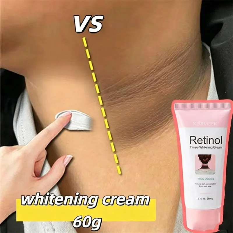 Retinol Whitening Cream Private Parts Underarm Bleaching Neck Lift Firm Butt Knee Brighten Inner Thigh Dark Remove Melanin 60g