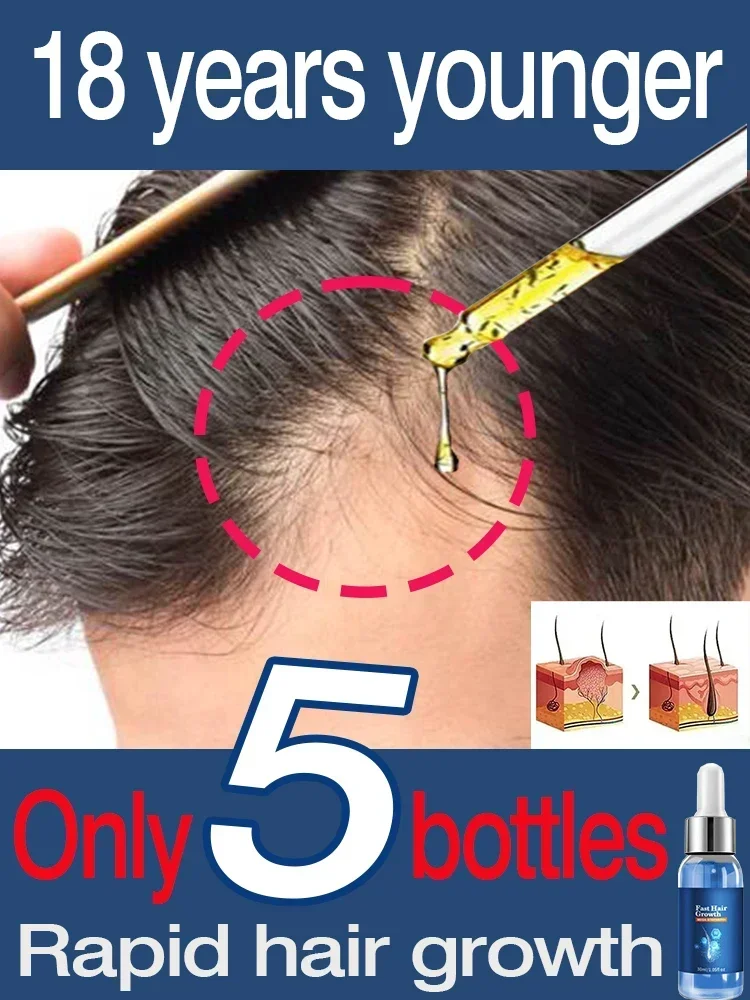 Fast Hair Growth Hair Growth Oil Effective Baldness Repair Hereditary Hair Loss Postpartum