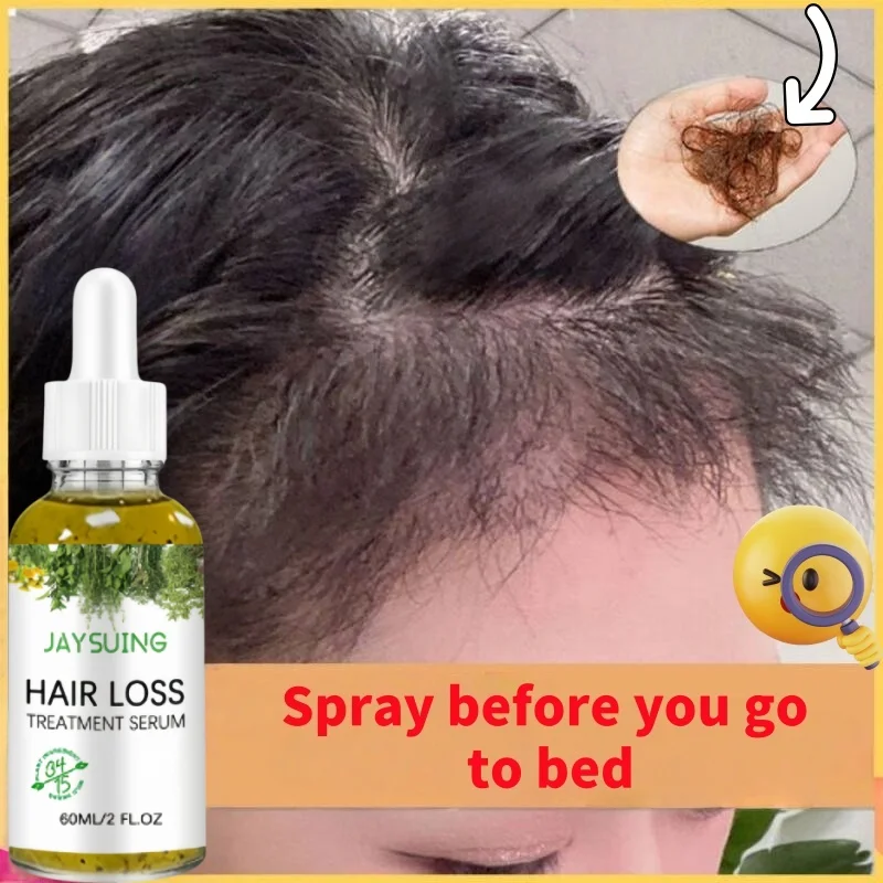 

Масло для быстрого роста волос Africa Crazy Traction Alopecia Serum против выпадения волос, спрей для лечения выпадения волос для мужчин и женщин, 60 мл