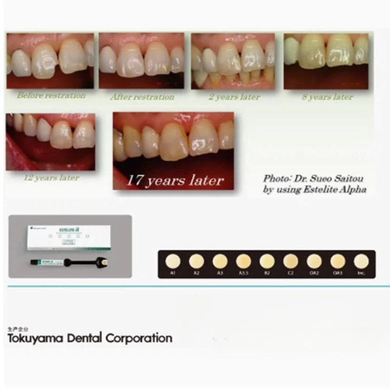 Рисунок 4 - Tokuyama ESTELTE ALPHA шприц A1 A2 A3 2 мл (3