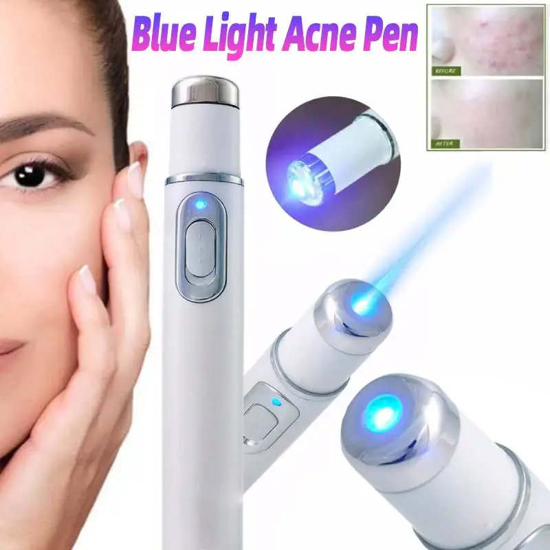 Blauwlichttherapie Acne Pen Oogschoonheidsapparaat Oogmassage Instrument Care Tool voor Relax Eye Donkere Kringen Oogzakken Wallen