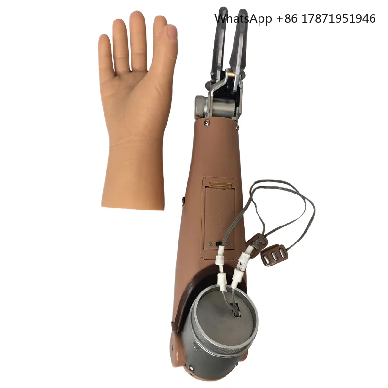 Two-Degree Freedom Myo Hand above Elbow Prosthetic Implants & Interventional Materials by Manufacturer