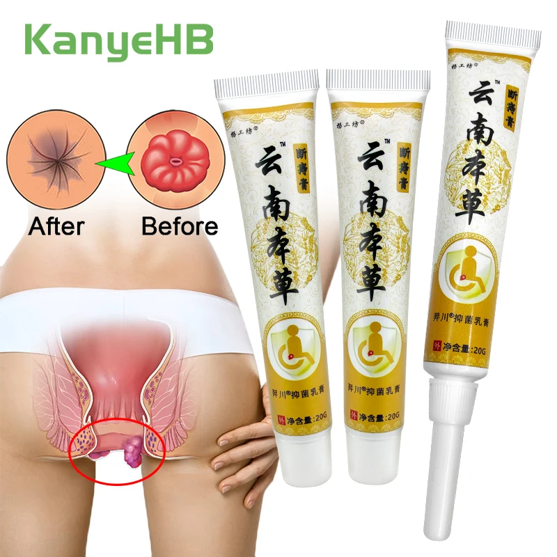 

3Pcs Chinese Medical Hemorrhoids Ointment Internal Hemorrhoids Piles External Fissure Therapy Relief Anal Pain Swell Bleed A1694