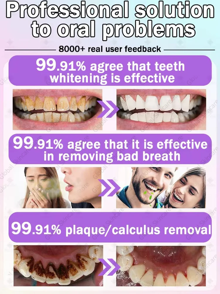 

Tartar removers dissolve tartar and remove stains in 2025