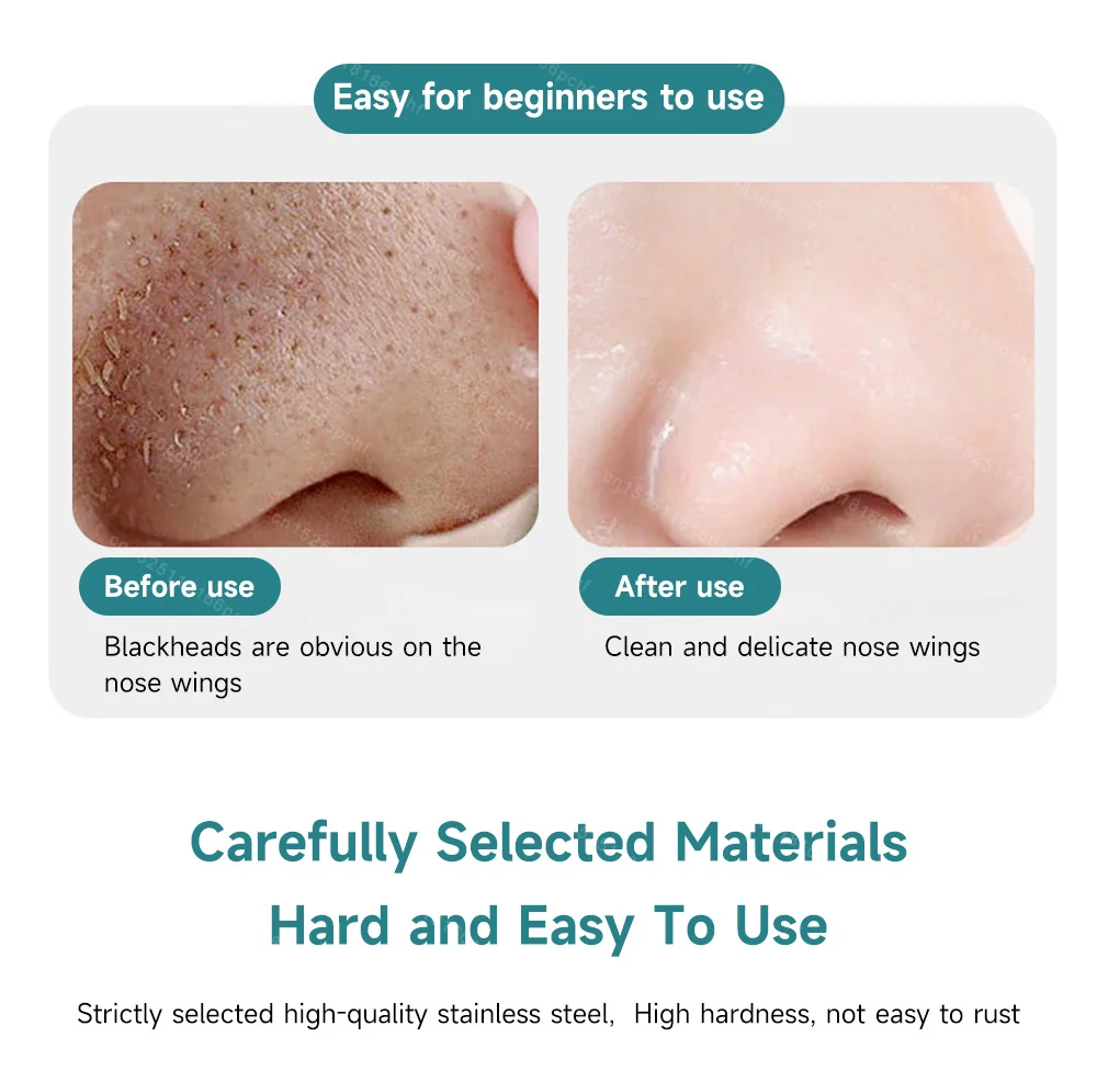 Tweekoppige Acne Mee-eter Verwijderen Naalden Roestvrij Stalen Naald Verwijderen Gereedschap Gezicht Huidverzorging Keratine Black Spot Pore Cleaner