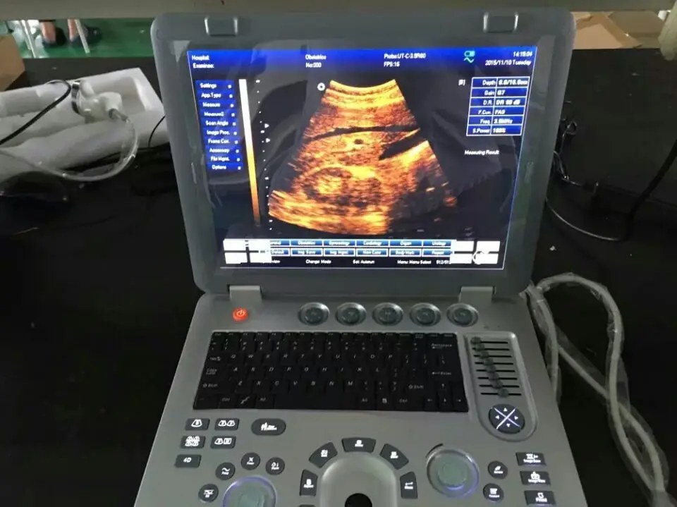 Ultrasound 4D Color Ultrasound machine 3D medical ultrasound instruments