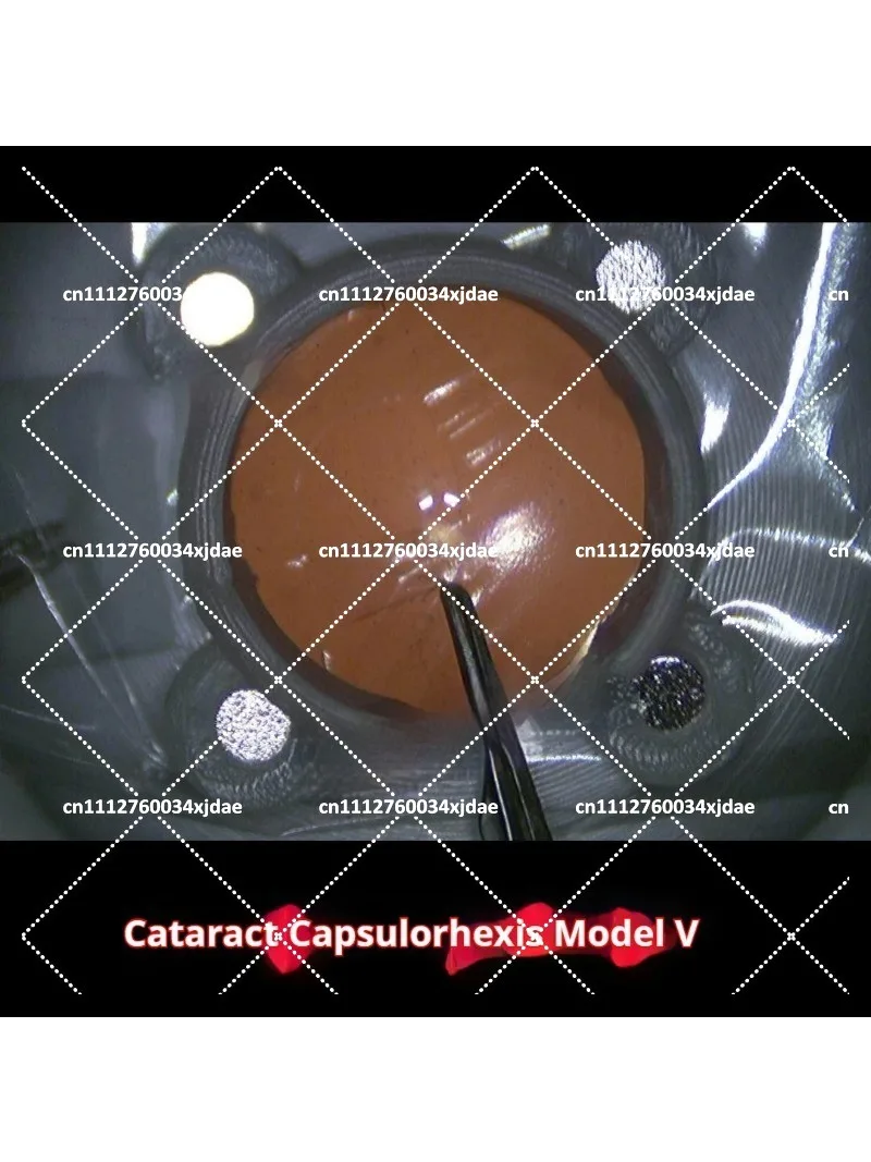 Ophthalmic Cataract Ultrasonic Emulsification Capsulorhexis Surgery Practice Model Realistic Red Reflex