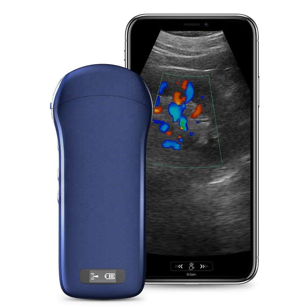 C10 Smartphone Ultrasound Price Wireless Charing Scanner Machine Linear/Convex/Cardiac 3-in 1 Probe Portable Ultrasound