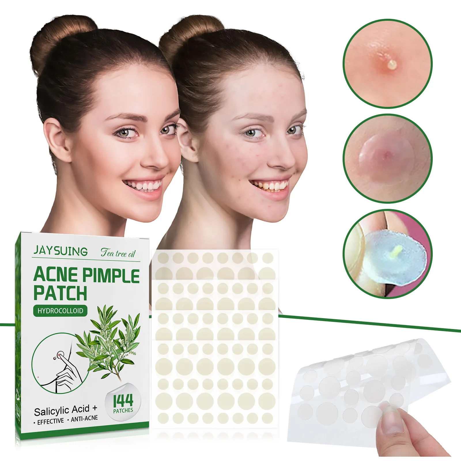 144 Patch Acne brufolo Patch viso adesivi invisibili olio di tè trattamento dell'acne rimozione Patch bellezza strumenti per l'acne cura della pelle del viso