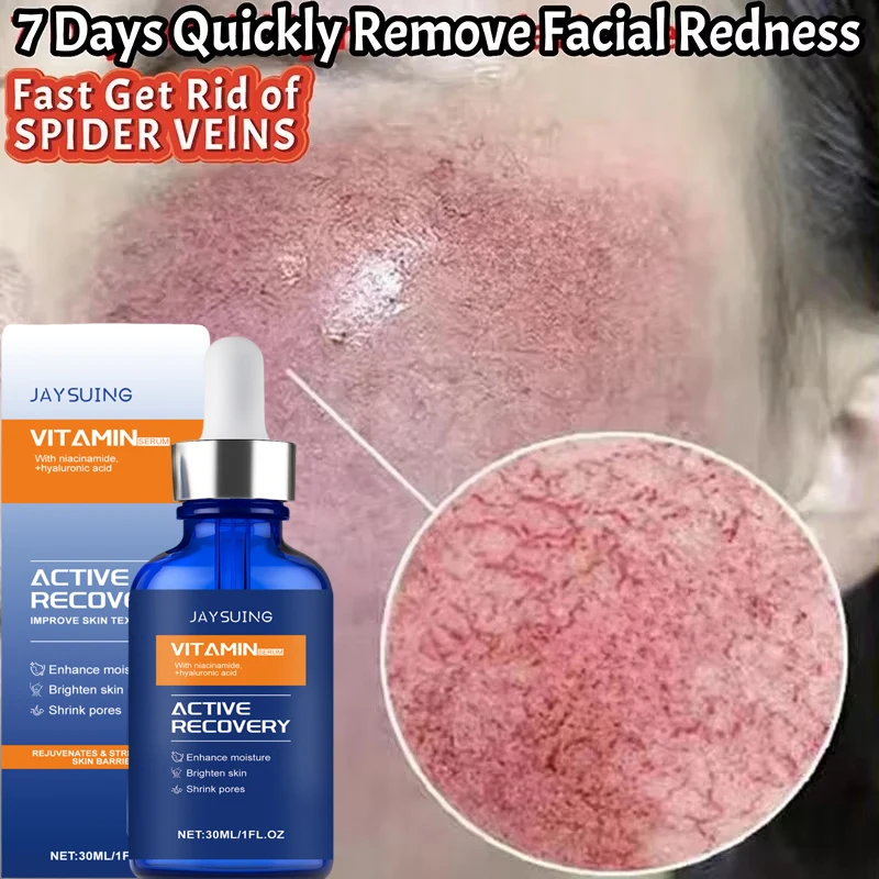 Facial Redness Repair Essence Improve Sensitive Skin Dryness Moisturizer Hydrating Sooth Lotion Removal Rosacea Korean Cosmetics