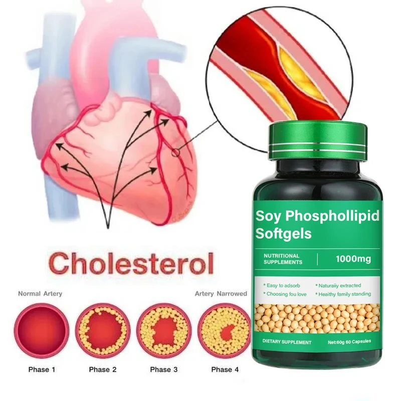 مرهم الأوعية الدموية منظف لانسداد الأوعية الدموية ، كبسولة الوقاية من athervietnam ، فوسفوليبيد فول الصويا المعتمدة من قبل ج