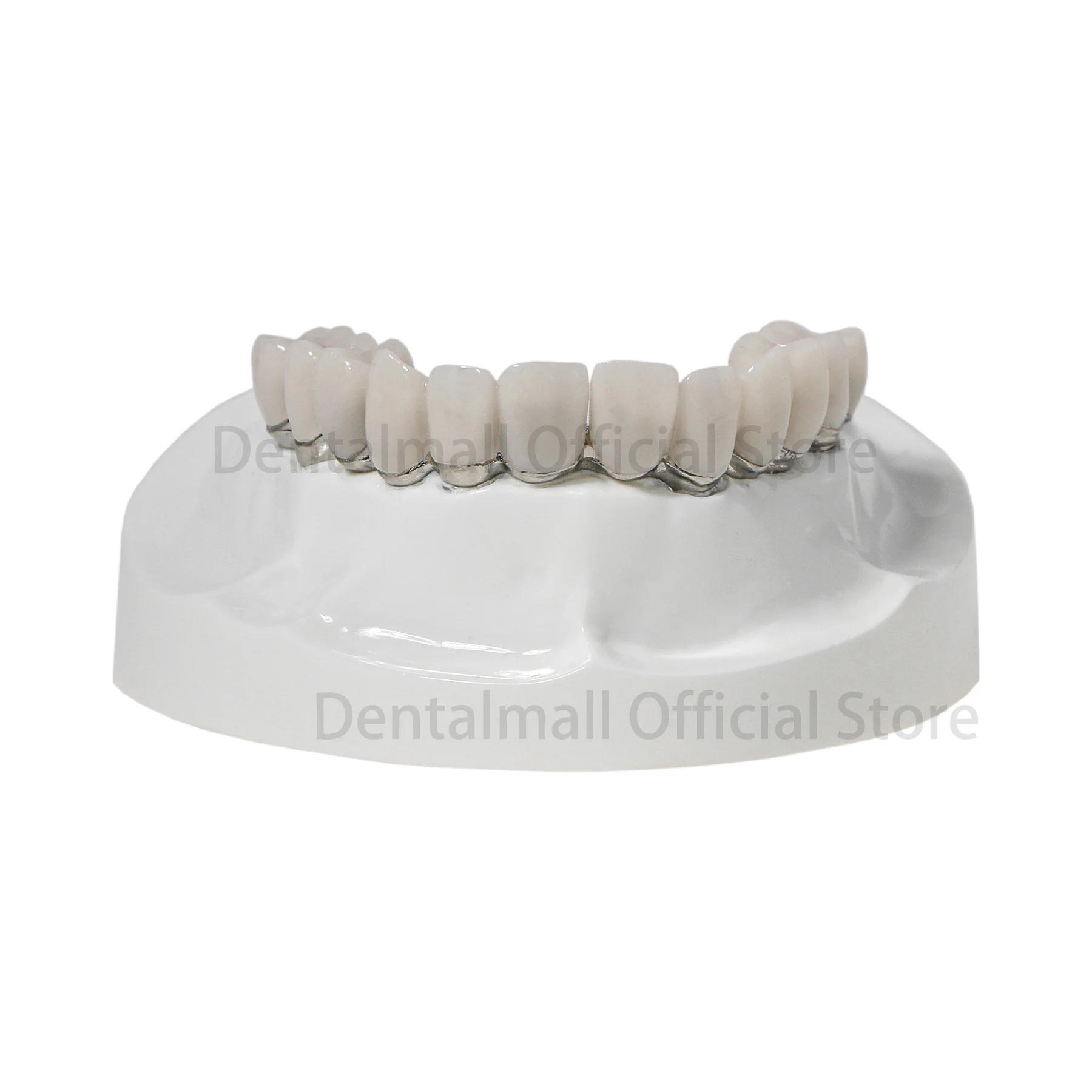 

Dental Overdenture Model Upper Jaw Implant Restoration Model 4 Screws Screwdrivers M6023