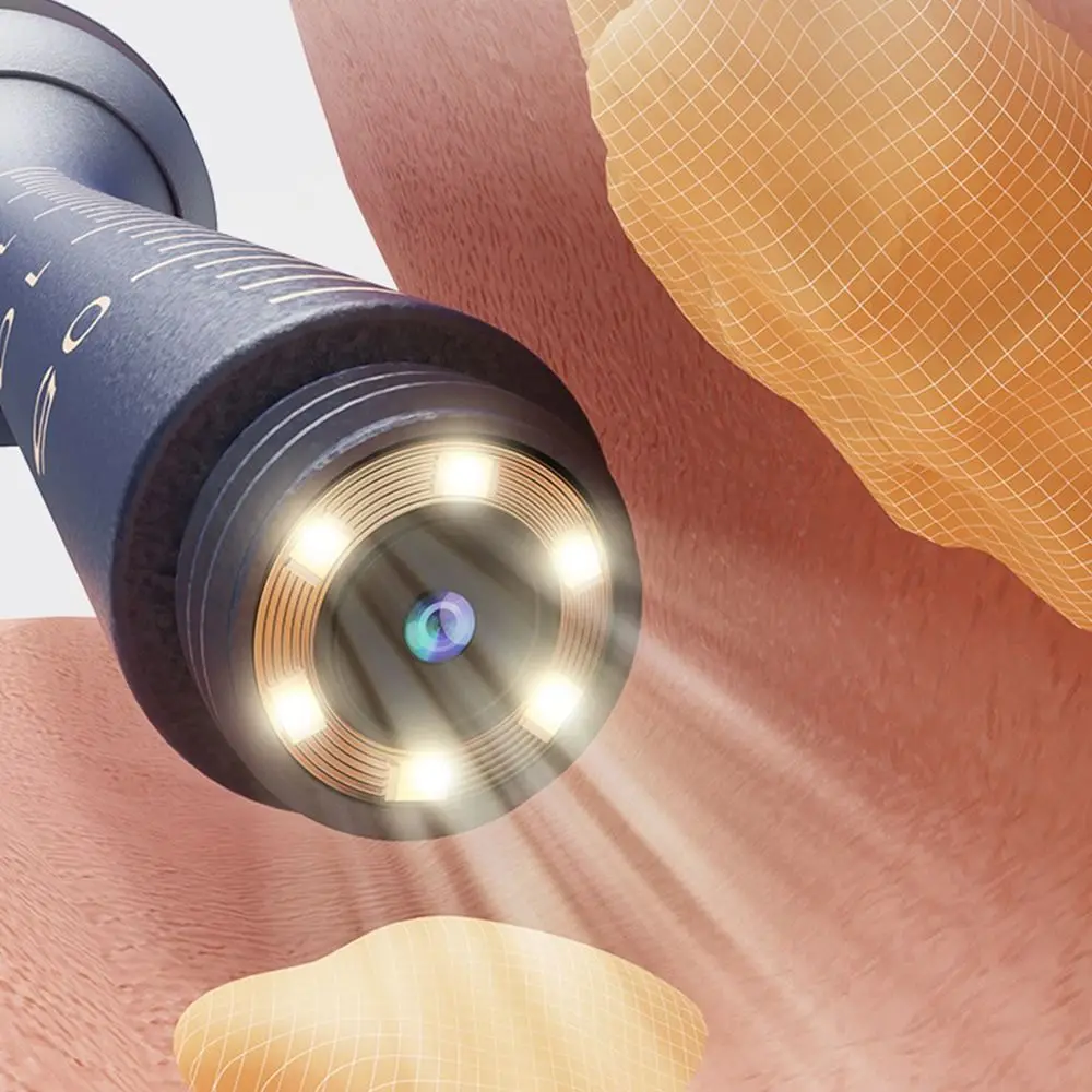 New EarSight Plus Smart Visual Ear Cleaner 6 LED Lights 1080P Earpicks with tweezer FHD Video Otoscope Ear Care