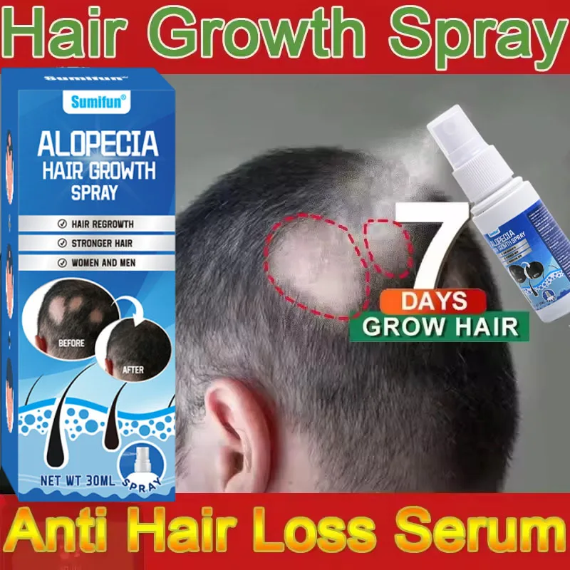 Snelle Haargroei Serum Spray Anti Haaruitval Voorkomen Kaalheid Hoofdhuid Behandeling Reparatie Wortels Schoonheid Gezondheid Haarverzorging Voor Mannen Vrouwen