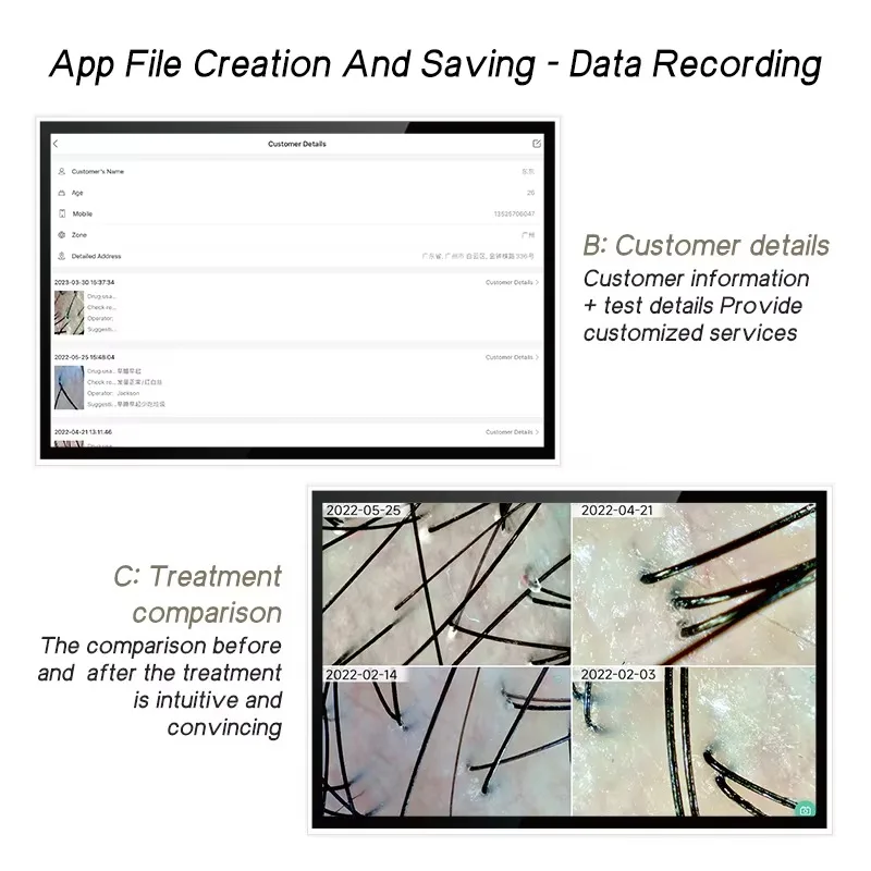 لاسلكي 20X/200X منظار الجلد فروة الرأس آلة تحليل بشرة الوجه الجلد المكبر فروة الرأس أداة تشخيص واي فاي المجهر اختبار الجلد