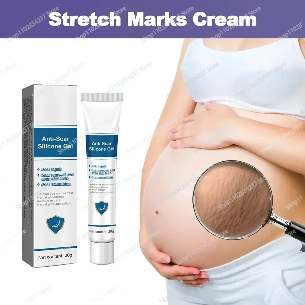 Stretch Mark Remover Permanent Stretch Mark Removerstretch marks remove scars