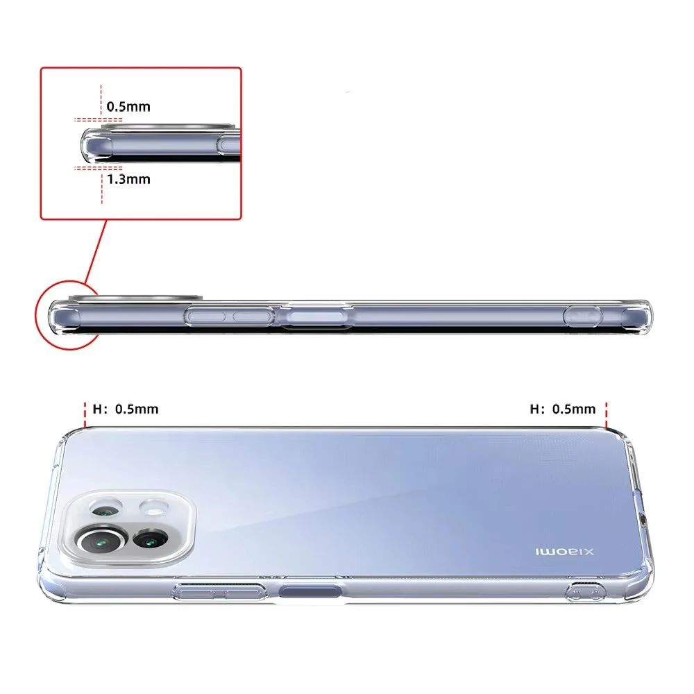 Ultradünne, klare Silikon-Softhülle für Xiaomi Mi 11 Lite Pro 12 13 14 Ultra 12S 11T 11 Lite 10T 9 9se 10 Transparente Hülle – Detail 5