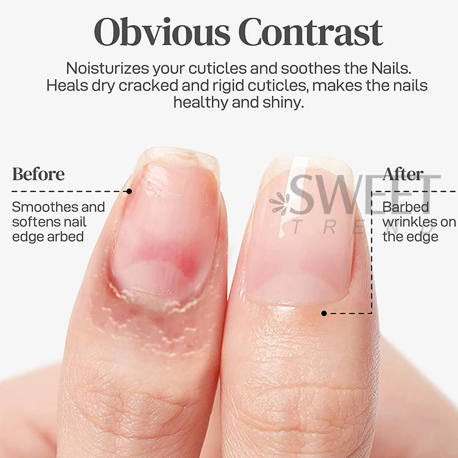 Aceite nutritivo para uñas de flores, 25ml, pétalos coloridos, tratamiento de uñas, aceite revitalizador de cutículas, previene el esmalte de uñas, nutre la piel