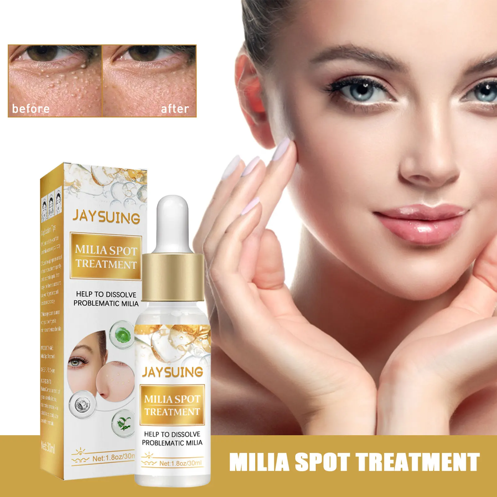 Milia Remover Essential30ml Dark Circle Serum For Eyes Dark Eye Circle Treatment Puffys Eyes Treatment Anti Ageing Eye Serum