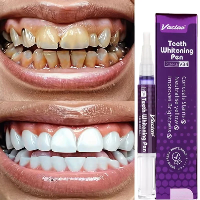 V34 ปากกาฟอกสีฟันยาสีฟันขจัดคร - Whitening Pen Bleach บทวิจารณ์และราคา