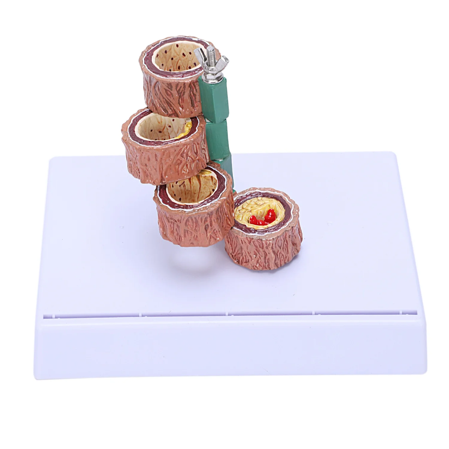 تصلب الشرايين نموذج التخثر أمراض الأوعية الدموية مظاهرة نموذج أمراض الأوعية الدموية على شكل قلب #5