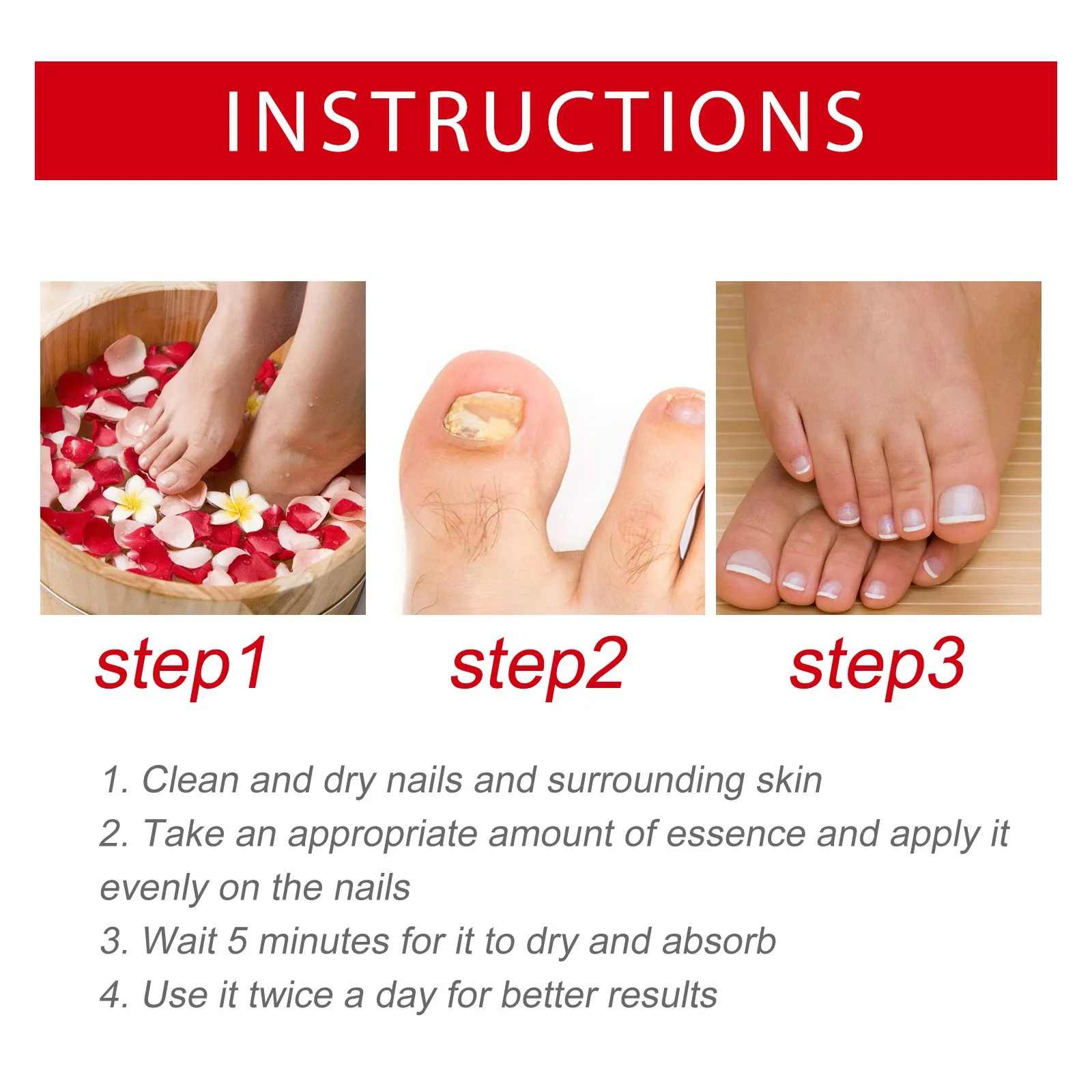 Nagelpflegeflüssigkeit, repariert Vergilbung, graue Fingernägel, Zehennägel, verdickt die Nägel, verhindert Nagelrotten, Nagelpflege-Essenz, 20 ml, sicher