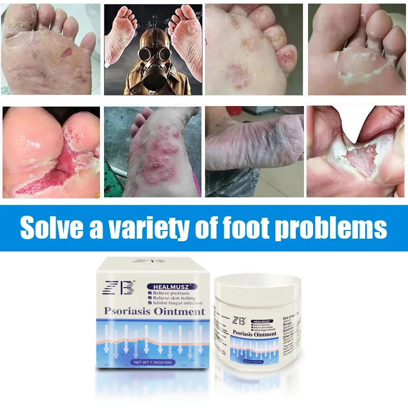 50g Chinese Beriberi Ointment Inhibit Fungi Remove Odor Repair Foot Skin Athlete\'s Foot Treatment Cream Tinea Pedis Cream