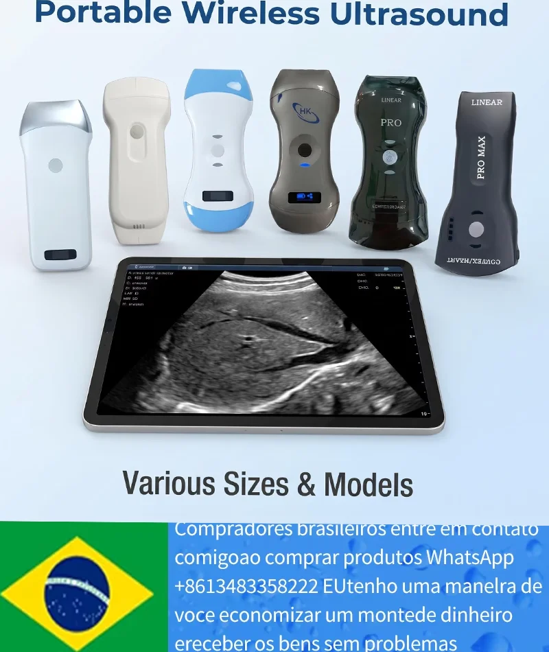 Scanner de Ultrassom Portátil Sem Fio, Sonda de Ultrassom Mini Portátil para Inspeção em Hospitais e Clínicas Humanas