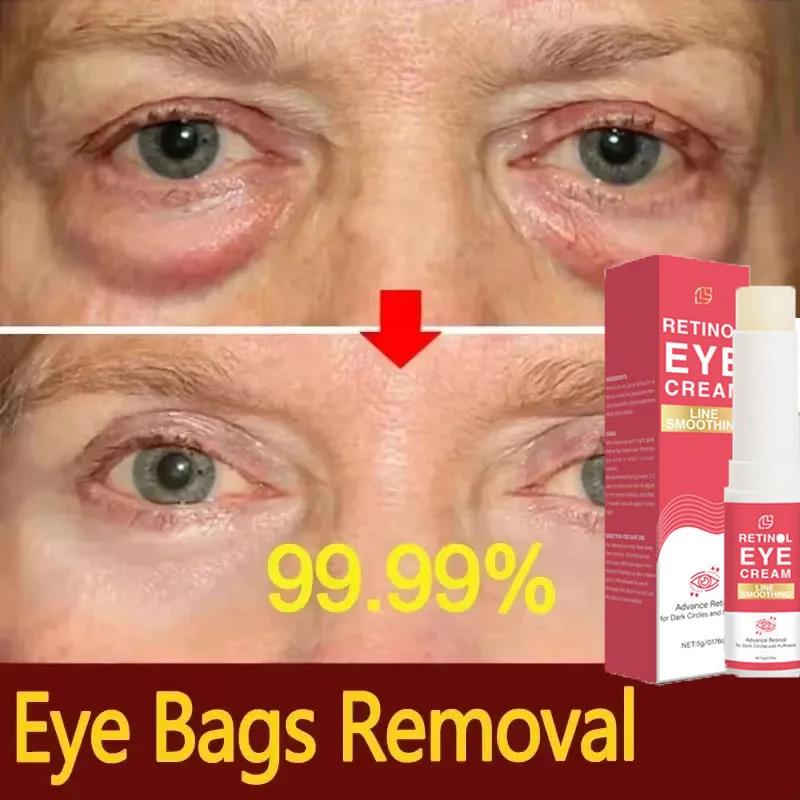 Retinol Eye Cream Stick Anti-Wrinkle Remove Eye Bags Dark Circles Puffiness Brighten Eye Serum Fade Fine Line Man Woman Eye Care