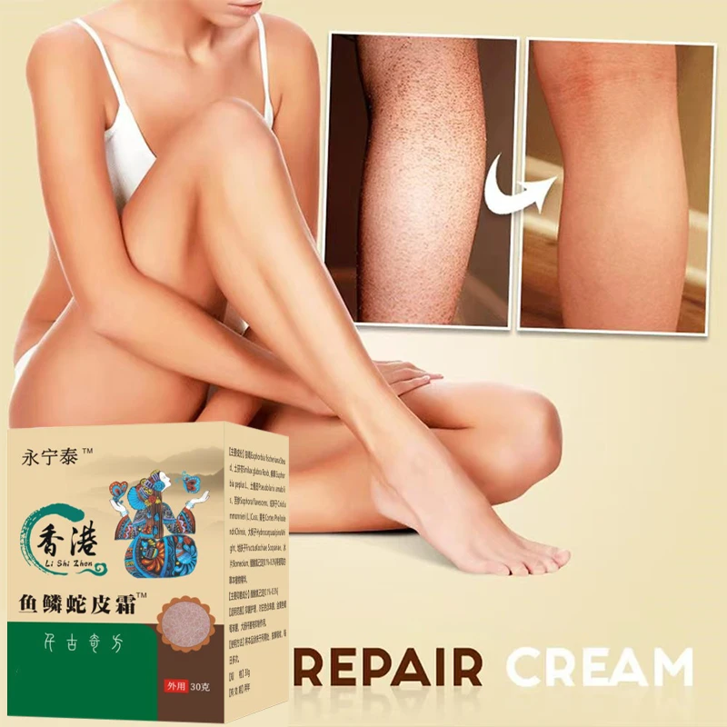 New Chicken Skin Repair Cream Curing Keratosis Follicle Pilaris Remove Thick Pores Body Dark Spot Moisturize Smooth Skin Care