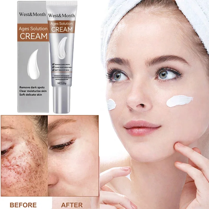 

Remove Freckle Cream Whitening Dark Spots Effective Remove Melasma Serum Melanin Moisturize Brighten Smooth Face Skin Care 20g