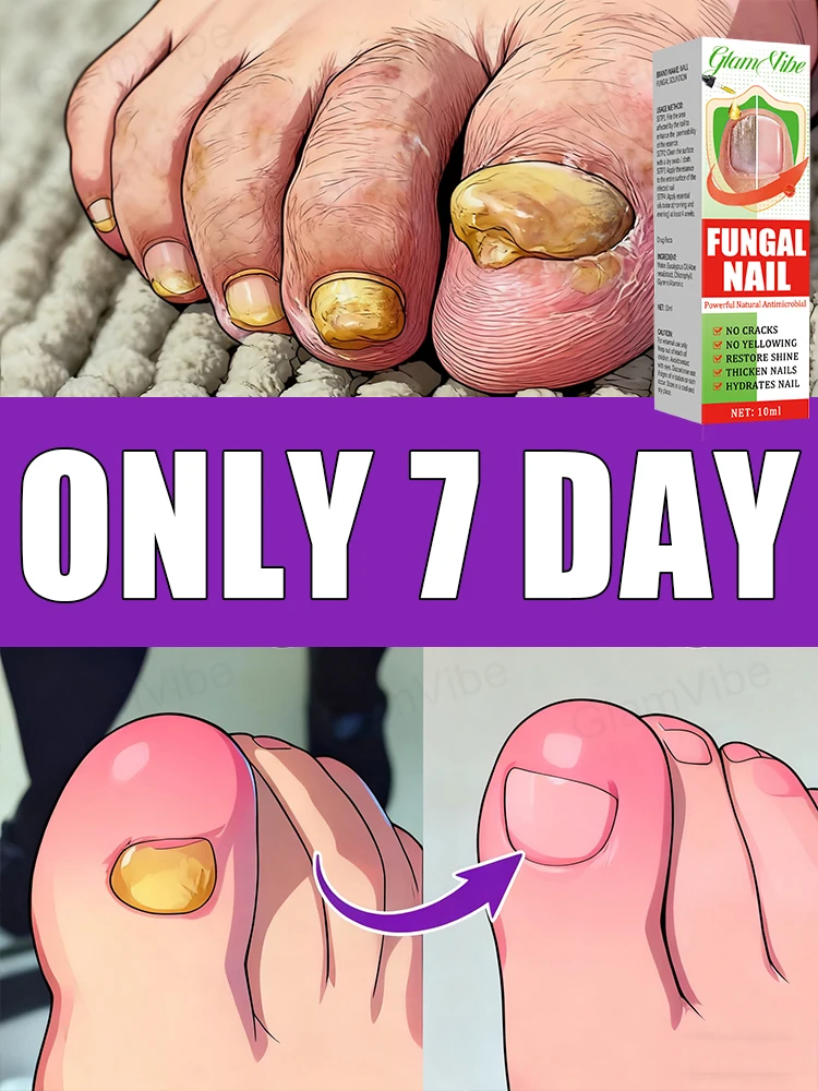 

Попрощайтесь с желтизной и неровностями, вырастите гладкие и блестящие ногти