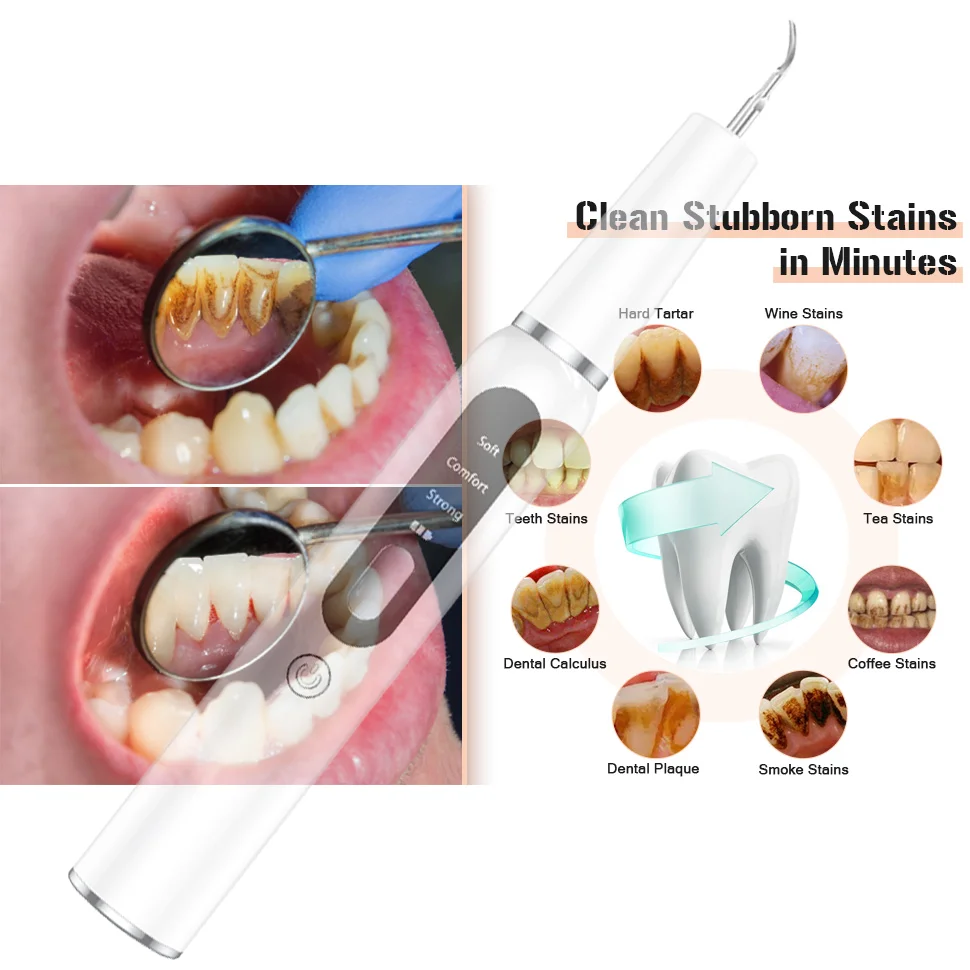 Dental escarificador ultrasónico para dientes, eliminador de sarro, manchas de cálculo Dental, limpiador de placa Dental sónico eléctrico,