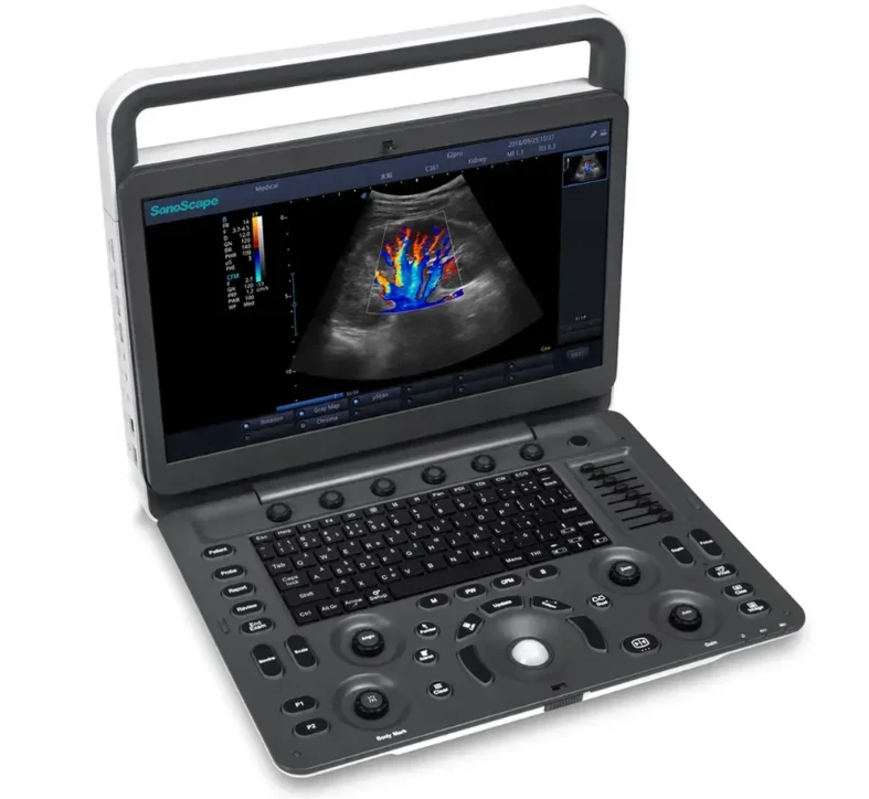 Ultrasound E2V Large Animal Portable Vet Ultrasound Machine for Pregnancy Test in Animals