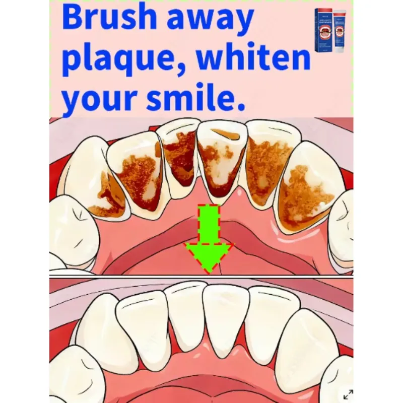 Remove dental plaque, repair enamel, whiten teeth, combat tartar, freshen breath, 30g