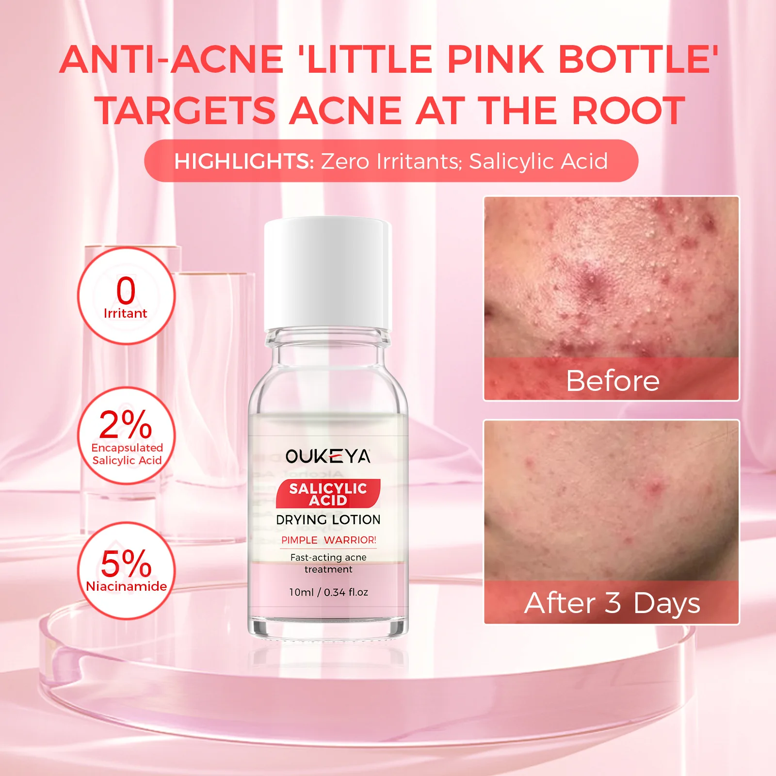 Lozione per l'essiccazione dell'acido salicilico Siero per il viso Trattamento notturno dell'acido dell'acne e delle macchie dell'acne per viso e corpo