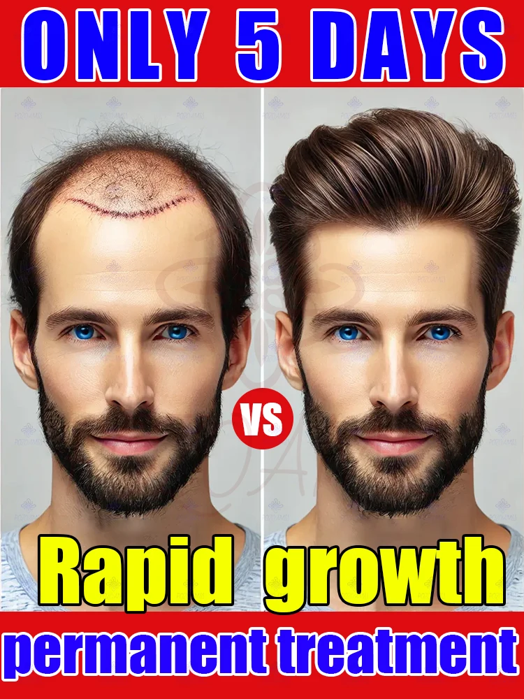 Rare find: spray that makes roots look denser