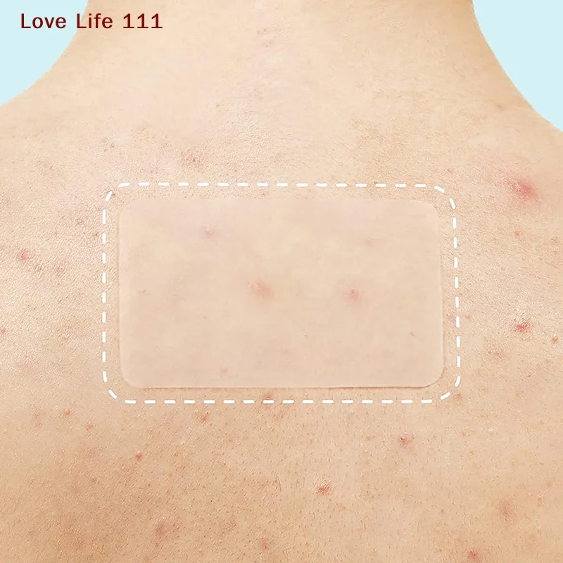 

Новинка, 30 шт./компл., пластырь от прыщей, невидимые наклейки для удаления прыщей, уход за кожей, консилер, пятно для лица, красота