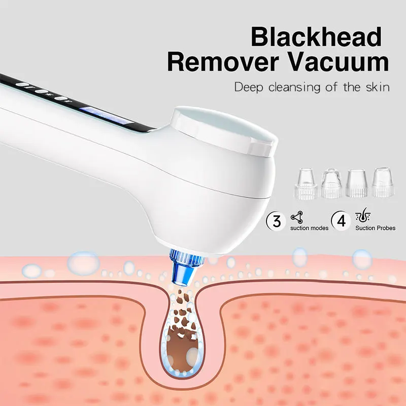 Macchina per la rimozione della testa nera Aspirapolvere per pori per la rimozione dei punti neri Pulizia profonda Cura del viso La più recente spazzola elettrica per la pulizia del viso