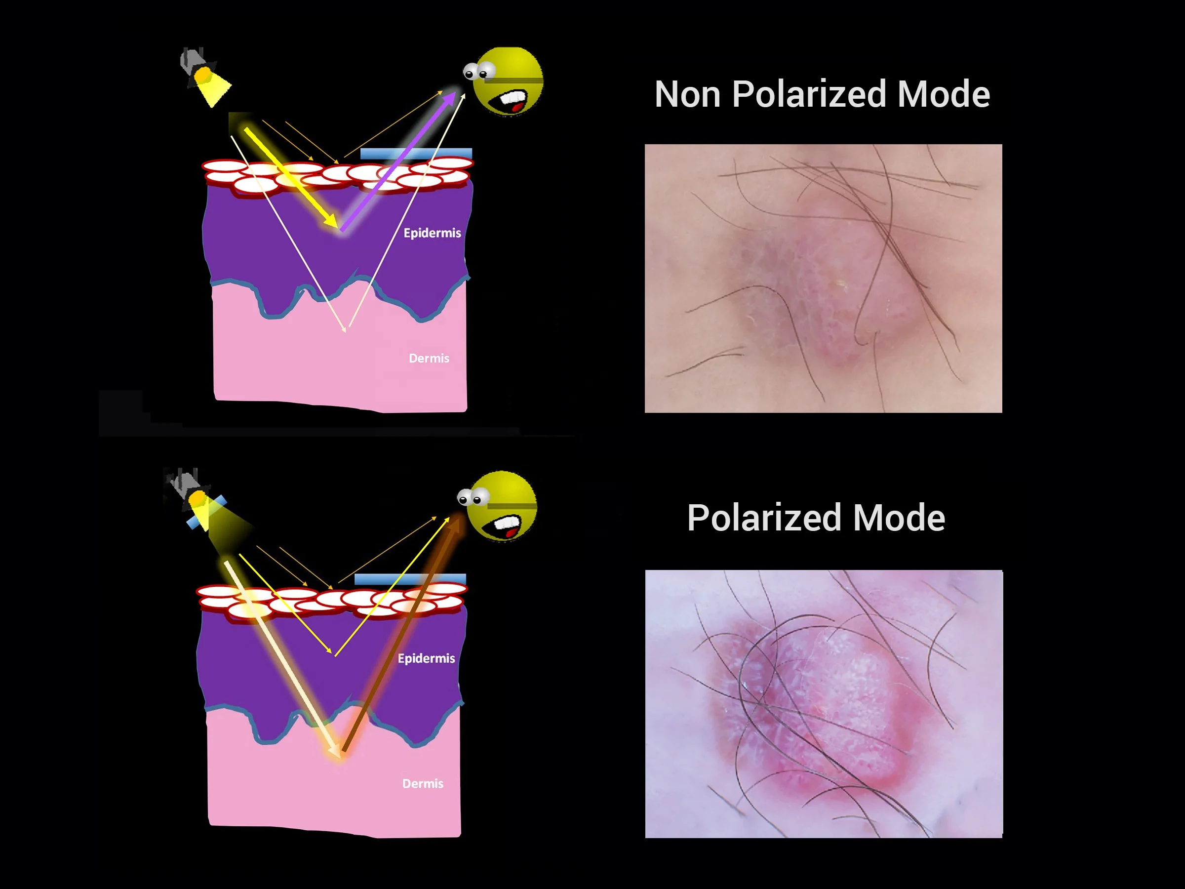 IBOOO Support OEM Very Cheap De3100 Mini Dermatoscope Medical Instruments