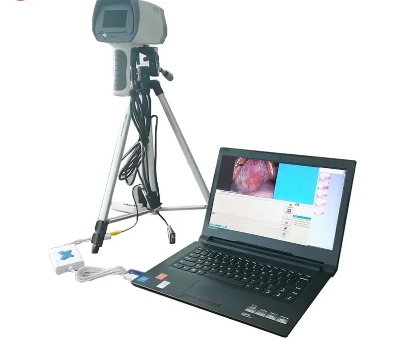 

Portable Digital Electronic Video