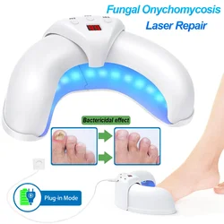 Fungal Nail Laser Device Repair Toenail Fingernail Treatment Anti Fungus Infection Paronychia Onychomycosis Ingrown Toenail