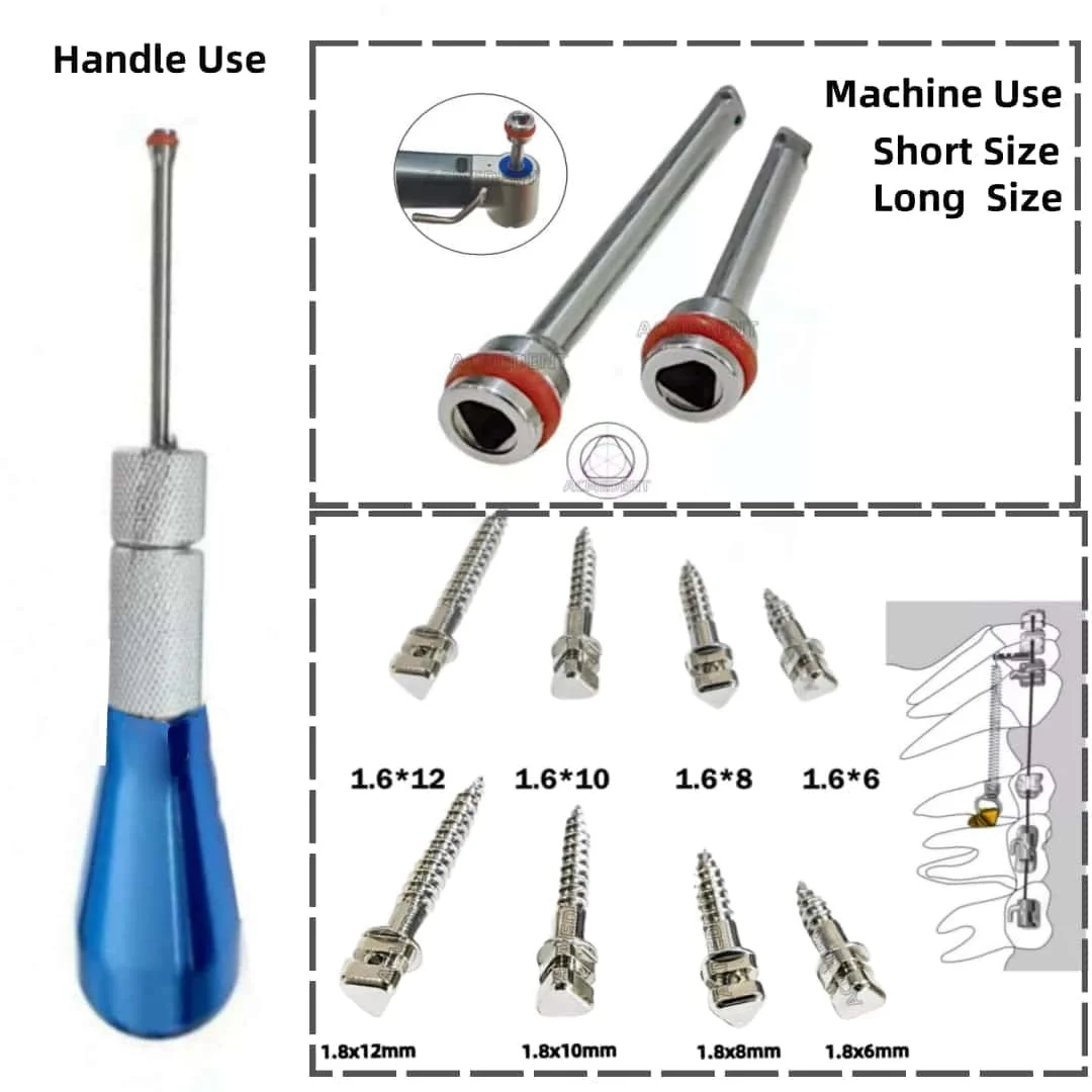 

Temporary Anchorage System Mandrel Implants - Mini Micro Screws with Handpiece Key Precise Orthodontic Applications Blue Driver