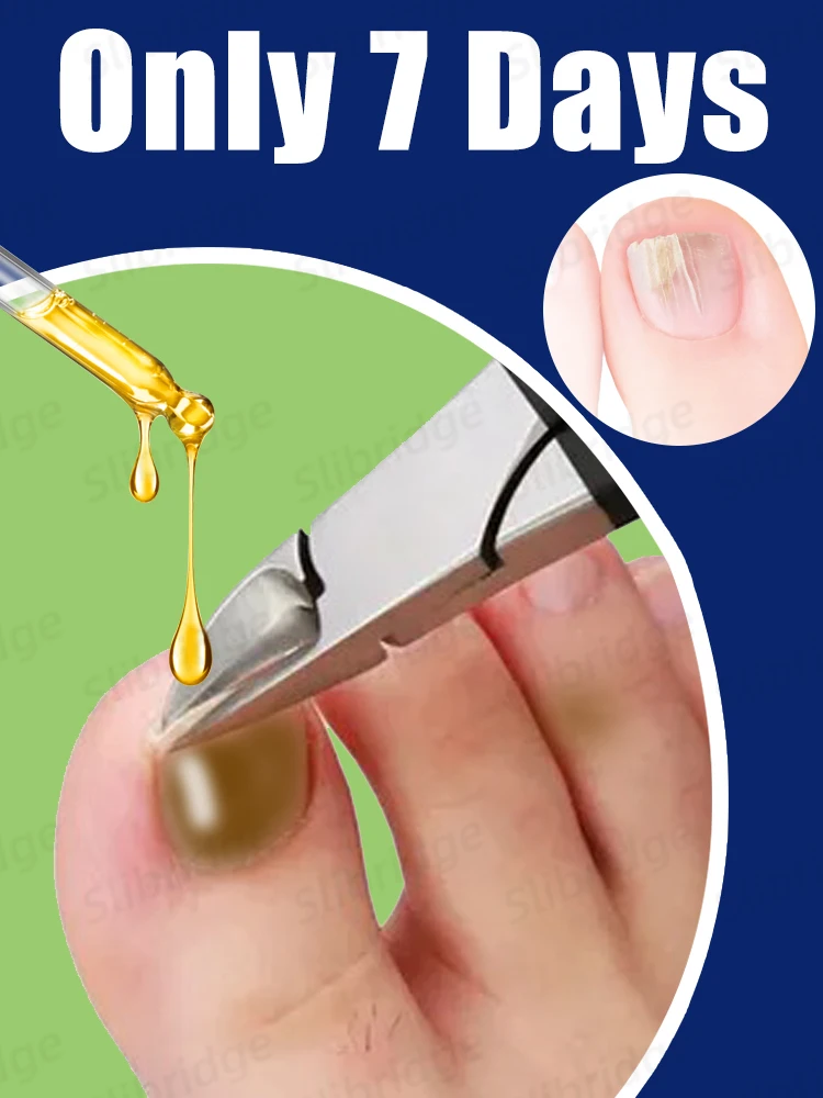 

manicure for bad Can in 7 days farewell