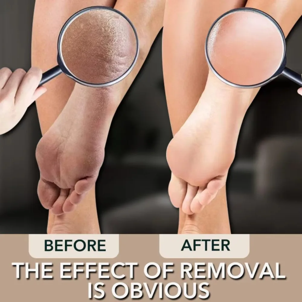 Lime à pied en verre Nano Double face professionnelle pour peau dure et morte, exfoliant de talon indolore, outil de soins de pédicure Durable