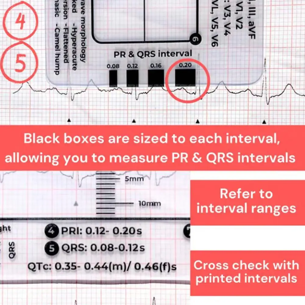 Ecg 7 passo régua portátil batimento cardíaco ecg observação transparente 7 passos escala ferramenta de medição régua para interpretação ecg