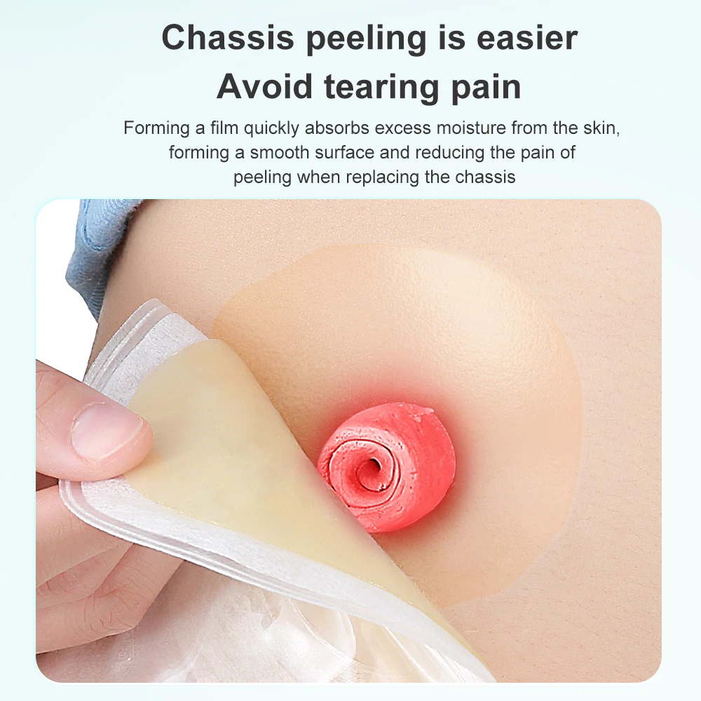 Рисунок 4 - защита кожи от стомы без спирта