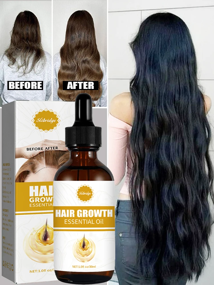 Hair regeneration oil repairs hair follicles on the head, increases hair volume, and prevents hair loss