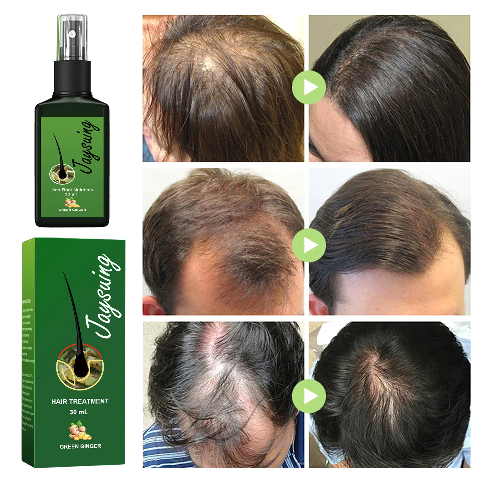 Spray De Crescimento De Cabelo De Gengibre Natural, Crescimento Rápido, Anti Perda De Cabelo, Soro Líquido, Couro Cabeludo, Tratamento Danificado, Reparação, Beleza Saúde, Raízes